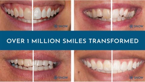 SNOW® Oral Care