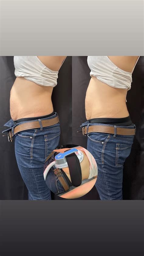 Obsidian Aura Med Spa